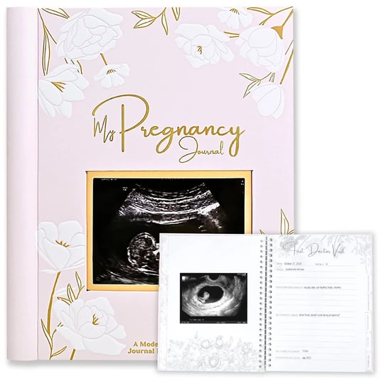 keababies-pregnancy-journal-pregnancy-announcements-80-pages-hard-cover-pregnancy-book-for-mom-to-be-1